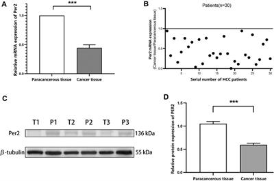 Period2 is associated with immune cell infiltration and is a potential diagnostic and prognostic marker for hepatocellular carcinoma